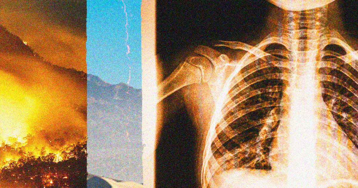 250515 valley fever california ms 2ef983.png